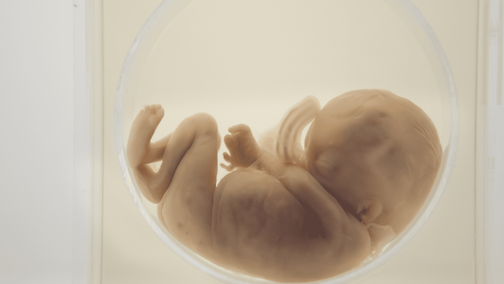 Could Human Post Implantation Embryo Models Revolutionize Our Understanding of Early Development?