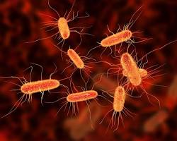 E Coli Outbreak at Local Restaurant: What You Need to Know