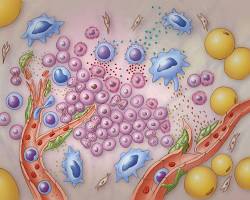 Enzymes Tumor Microenvironment cancer imunotherapy:A New Frontier