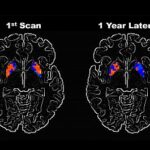 Parkinson's enzyme inhibitor