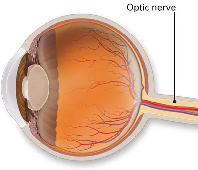 Glaucoma The Silent Thief of Sight Symptoms Risks and Prevention Strategies