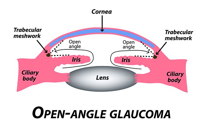 Glaucoma The Silent Thief of Sight Symptoms Risks and Prevention Strategies