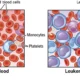 Modified protein against leukemia