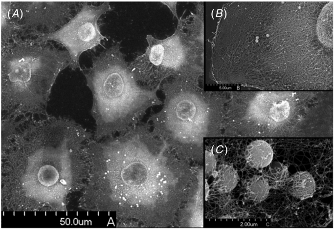 Pancreatic Cancer Protein SFRP2