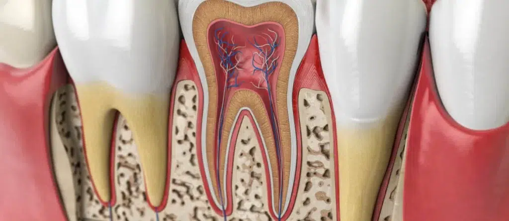 Regenerative Endodontics Hope For Tooth Decay Treatment