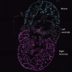 Tiny Multi-Chamber Heart Organoids