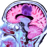 Blood Brain Barrier Breakthroughs