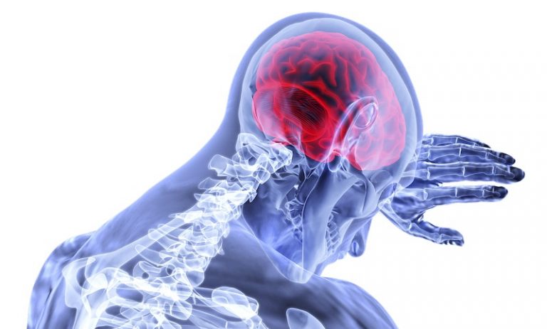 Stroke Treatment Breakthrough? Saving Brain Cells After 6 Hours