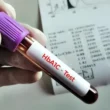 HbA1c Test