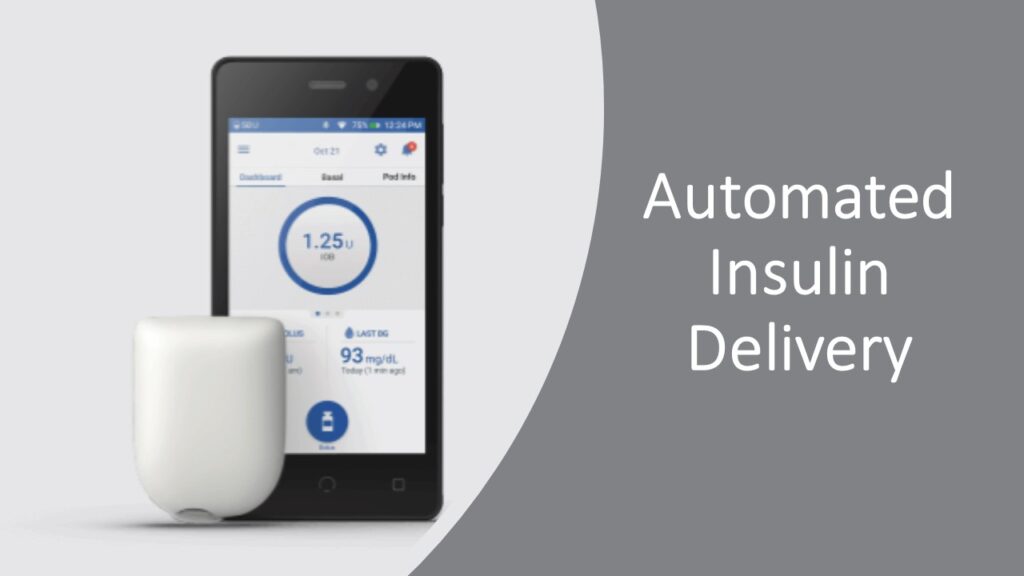 Automated Insulin Delivery