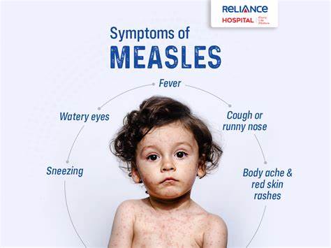 Measles Exposure at Sacramento Hospital: What You Need to Know