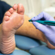 Diabetic Foot Care