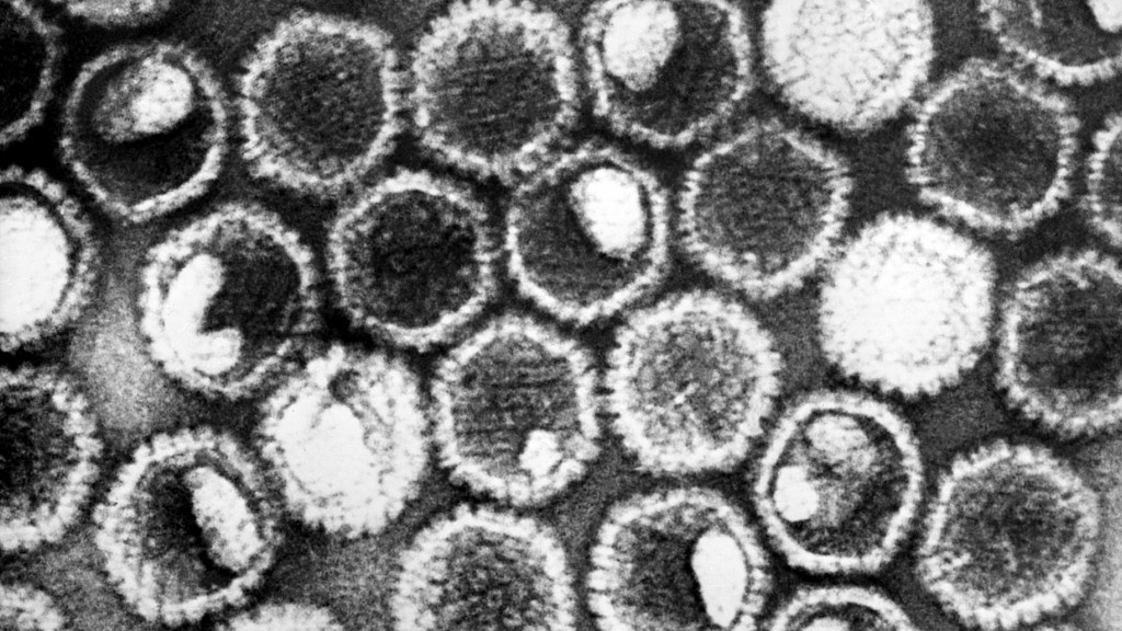 Breakthrough in Cancer Research: How a Herpesvirus Fuels Cancer Growth