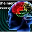 Personal Stories of Alzheimer's Disease