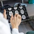 Brain Scans for Alzheimer's Diagnosis