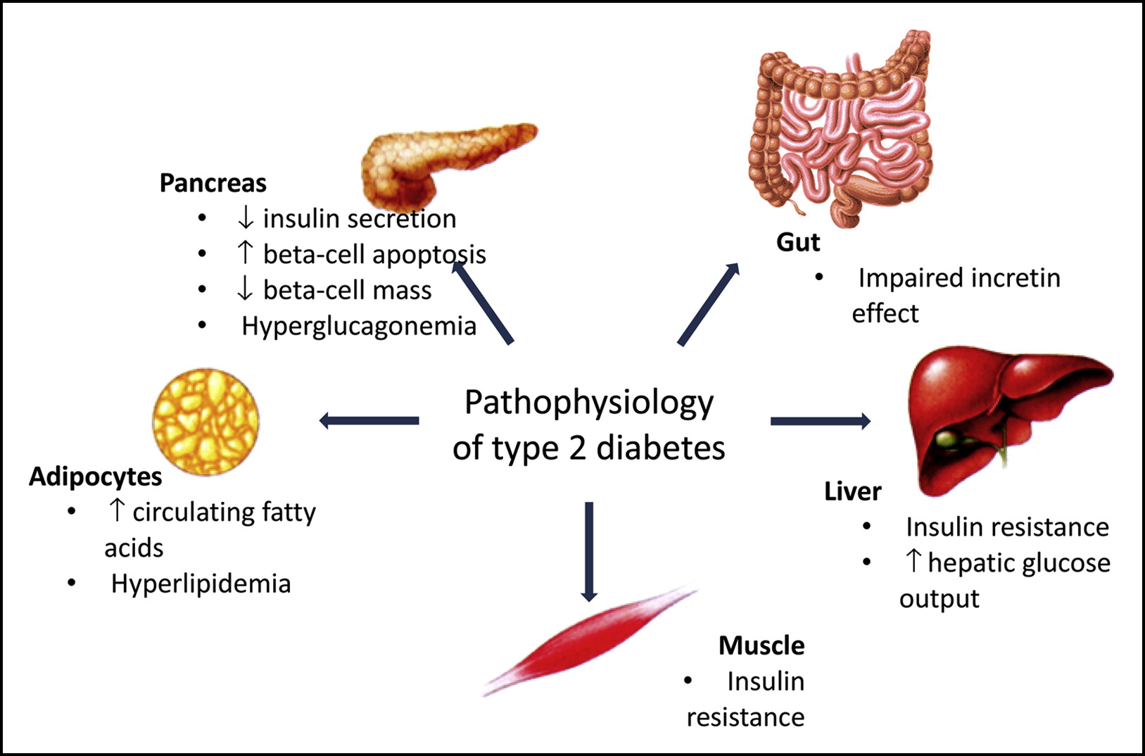 Understanding Diabetes: What’s Happening Inside Your Body? (Pathophysiology of Diabetes Mellitus)