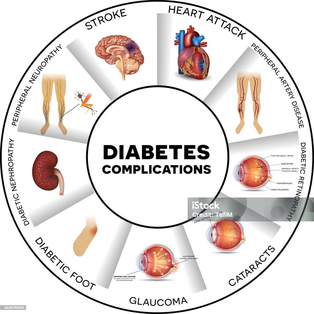 Diabetes Complications: Acute vs. Chronic Threats to Your Health