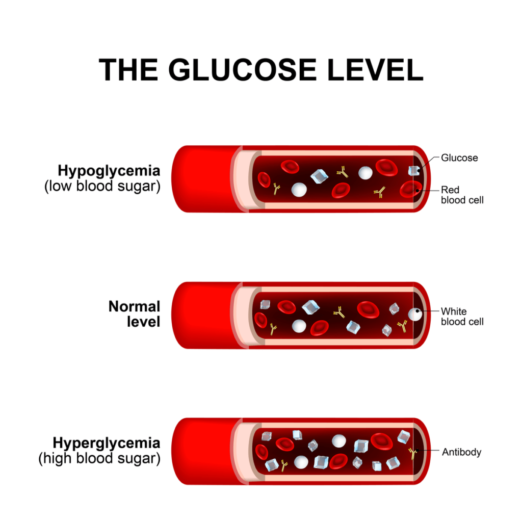 the glucose level