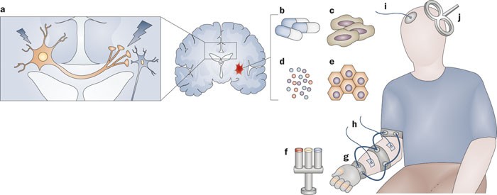 Stroke Recovery: How Your Brain Heals Itself with Neuroplasticity