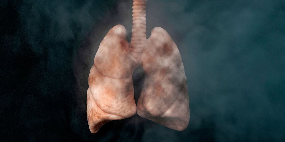 Beyond Smoking: Unveiling the Hidden Risk Factors for COPD