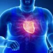 Obesity and Heart Disease Risk