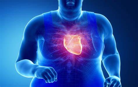 Obesity & Heart Disease: How Excess Weight Affects Your Heart Health