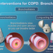 Novel Treatments for COPD