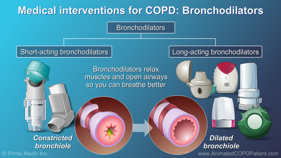 Beyond Bronchodilators: Cutting-Edge Therapies for COPD Management