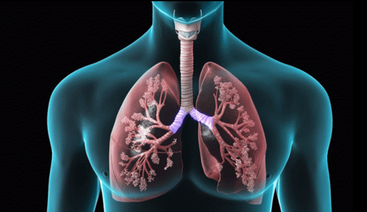 Chronic Obstructive Pulmonary Disease (COPD): Understanding and Managing Your Breathlessness