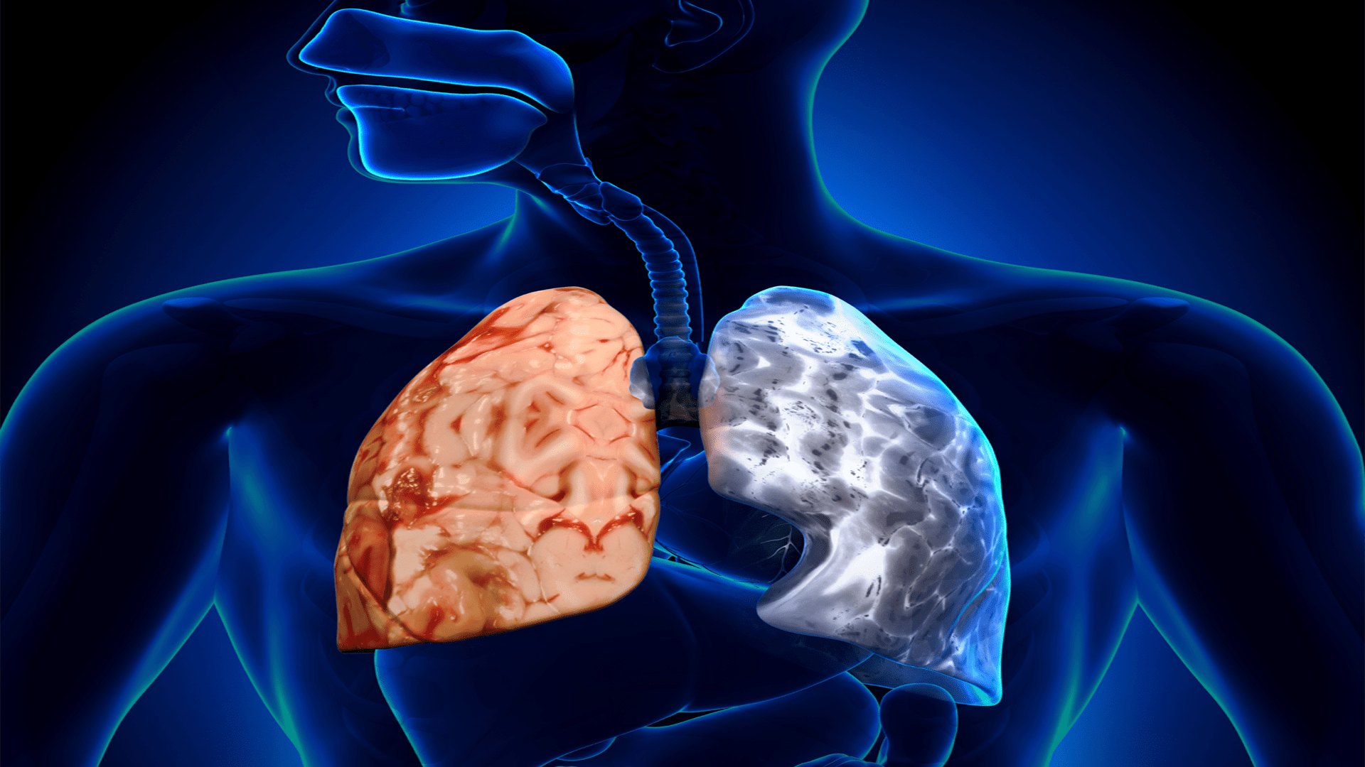 COPD: A Silent Threat – Prevalence, Deaths & Economic Costs Explained