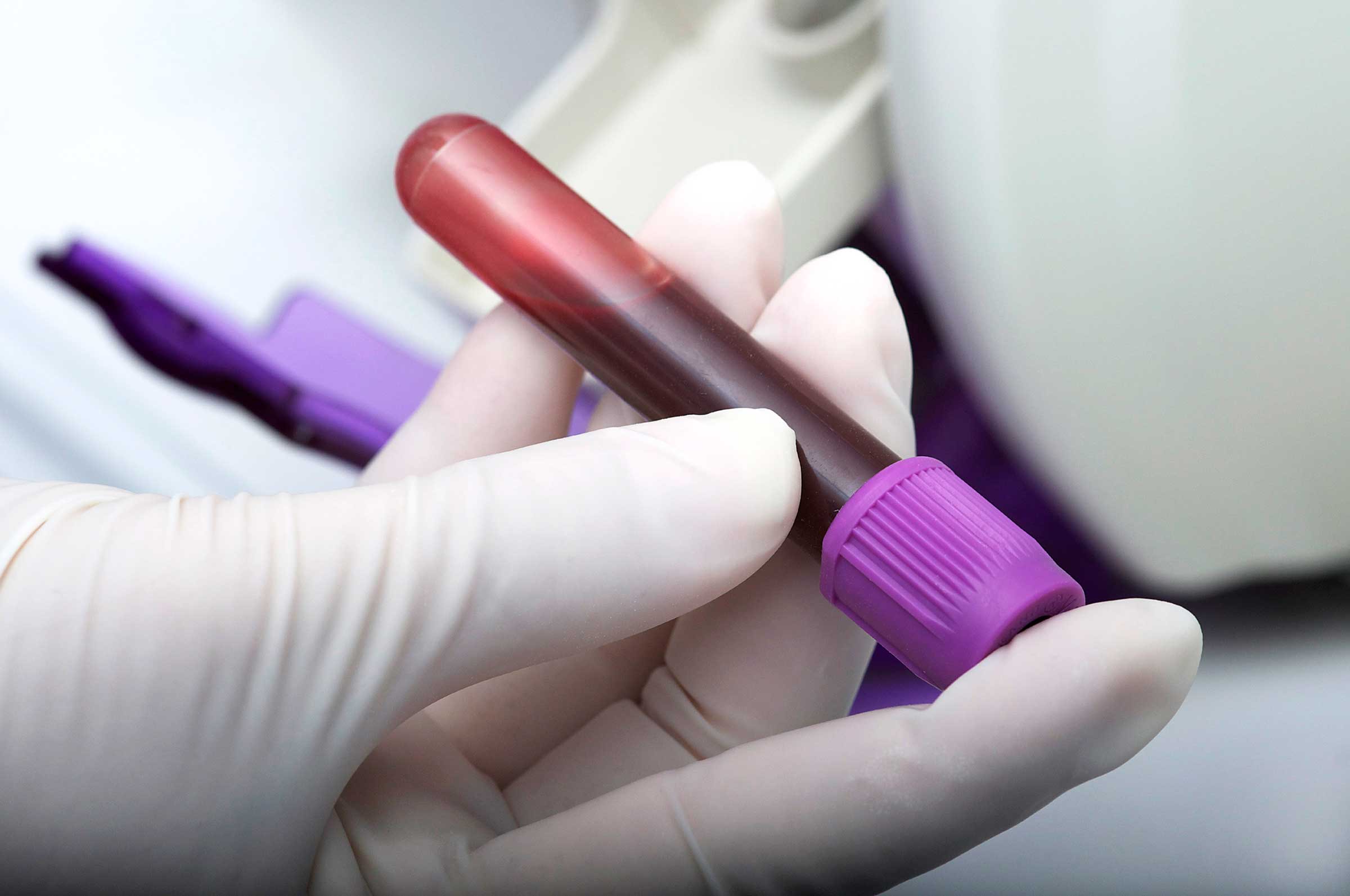 Blood Tests for Heart Disease