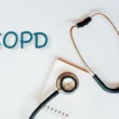 Novel Therapies for COPD