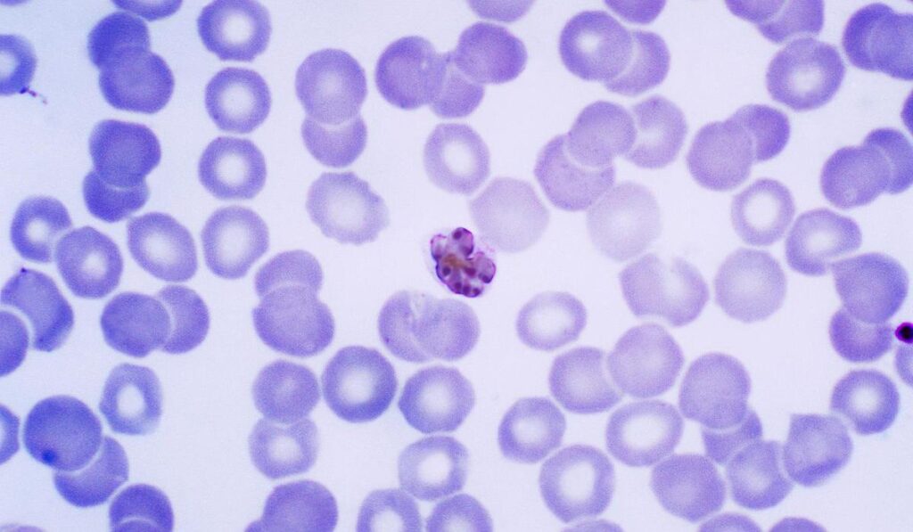 Mature Plasmodium malariae