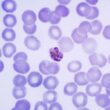 Plasmodium Species in Malaria