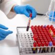 HIV/AIDS research advancements
