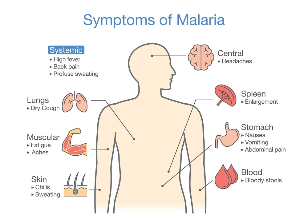 Symptoms of Malaria