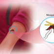 Malaria Diagnosis Methods Explained