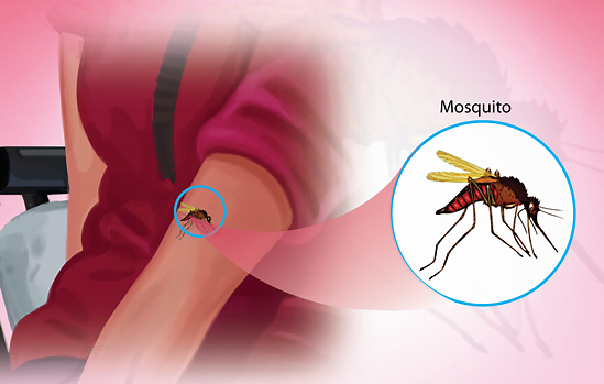 Malaria Diagnosis Methods Explained